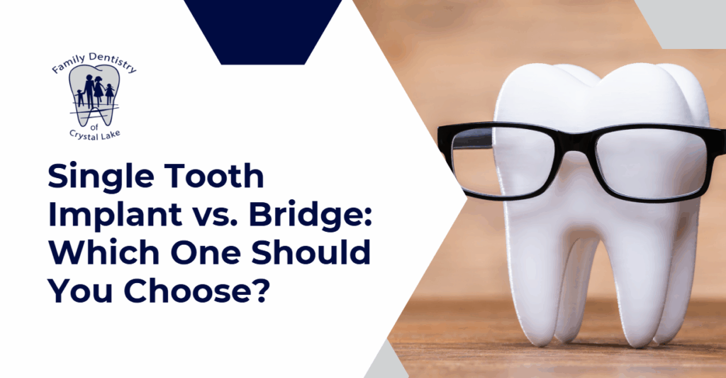Single Tooth Implant vs. Bridge: Which One Should You Choose? 17 Single Tooth Implant vs. Bridge: Which One Should You Choose? | unnamed 2025 05 26T195309.788 | Family Dentistry of Crystal Lake