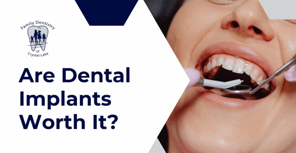 Are Dental Implants Worth It? 13 (Woman undergoing a dental exam with mirror and probe tools, paired with text asking if dental implants are worth it.)
