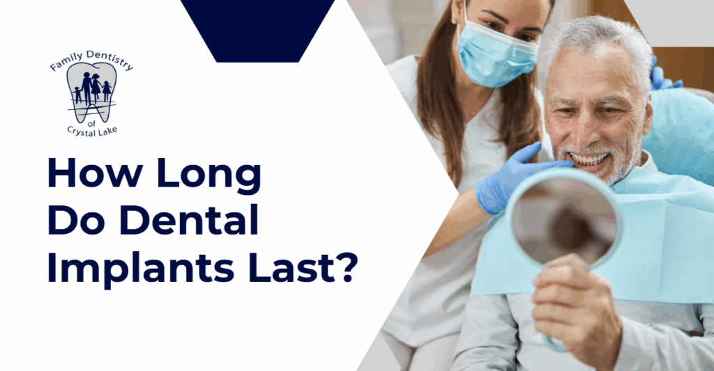 How Long Do Dental Implants Last? 9 (Smiling older man looking at his teeth in a mirror while a dental professional stands beside him, with text asking how long dental implants last.)