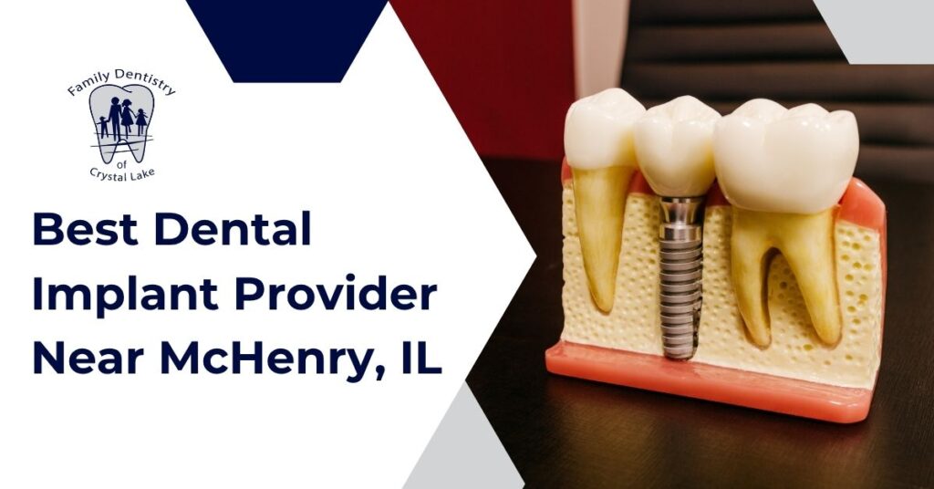 Best Dental Implant Provider Near McHenry, IL 1 Best Dental Implant Provider Near McHenry, IL | FDC Cover Best Dental Implant Provider Near McHenry IL 3 | Family Dentistry of Crystal Lake