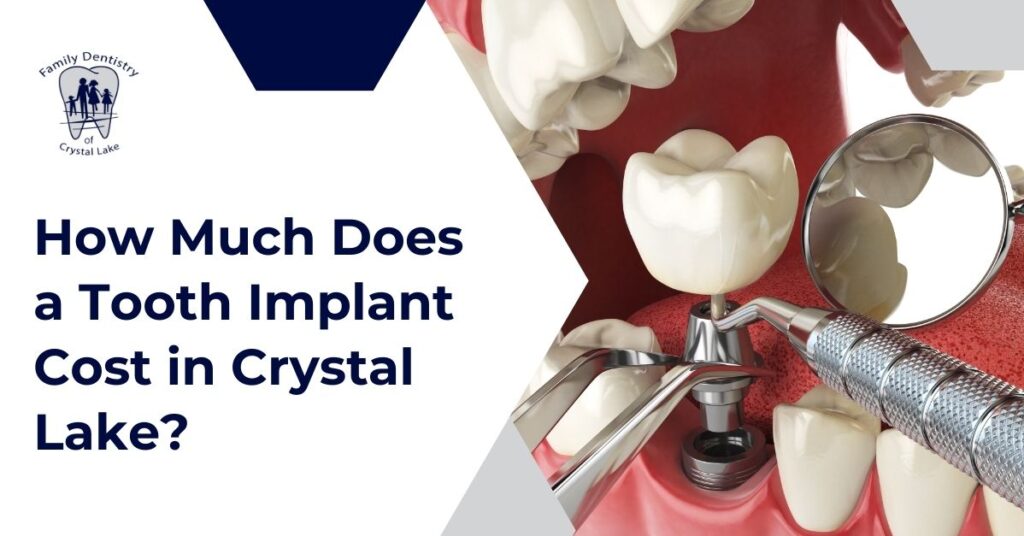 How Much Does a Tooth Implant Cost in Crystal Lake? 34 Patient learning about tooth implant cost in Crystal Lake dental office