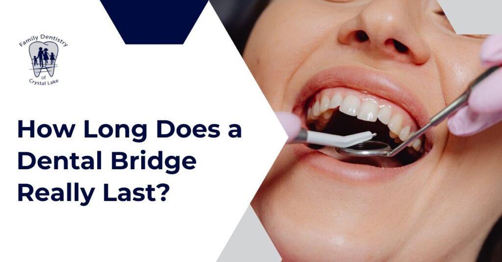 How Long Does a Dental Bridge Really Last? 30 Dentist showing dental bridge model to patient