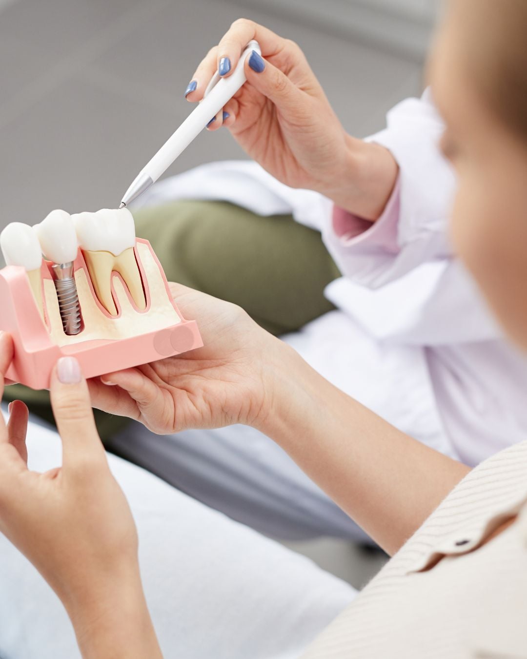 Benefits of Choosing Dental Implants