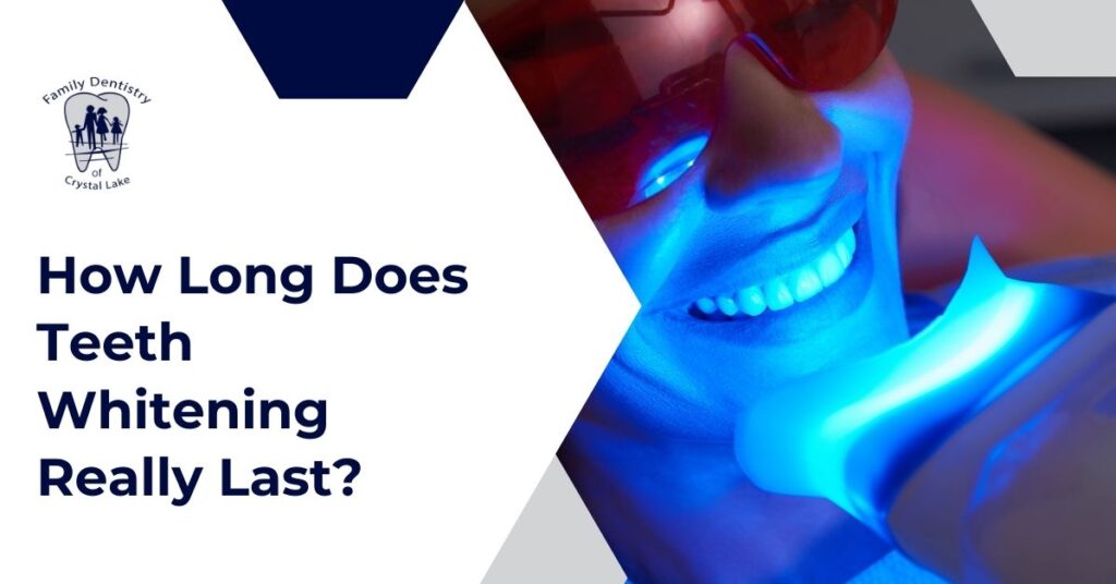 How Long Does Teeth Whitening Really Last? 13 Bright white smile after professional whitening treatment