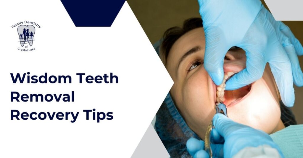 Wisdom Teeth Removal Recovery: What to Expect and What to Eat 16 Patient resting after wisdom teeth removal surgery