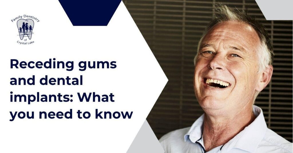 Receding Gums and Dental Implants: What You Need to Know Before Treatment 24 Receding Gums and Dental Implants: What You Need to Know Before Treatment | img26 | Family Dentistry of Crystal Lake