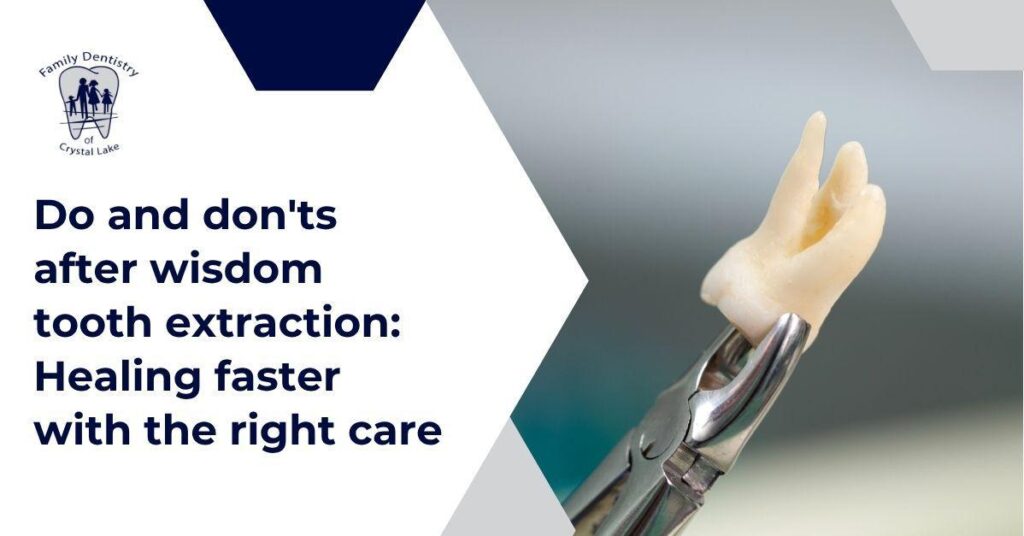 Dos and Don’ts After Wisdom Tooth Extraction: Healing Faster with the Right Care 20 Dos and Don’ts After Wisdom Tooth Extraction: Healing Faster with the Right Care | img9 | Family Dentistry of Crystal Lake