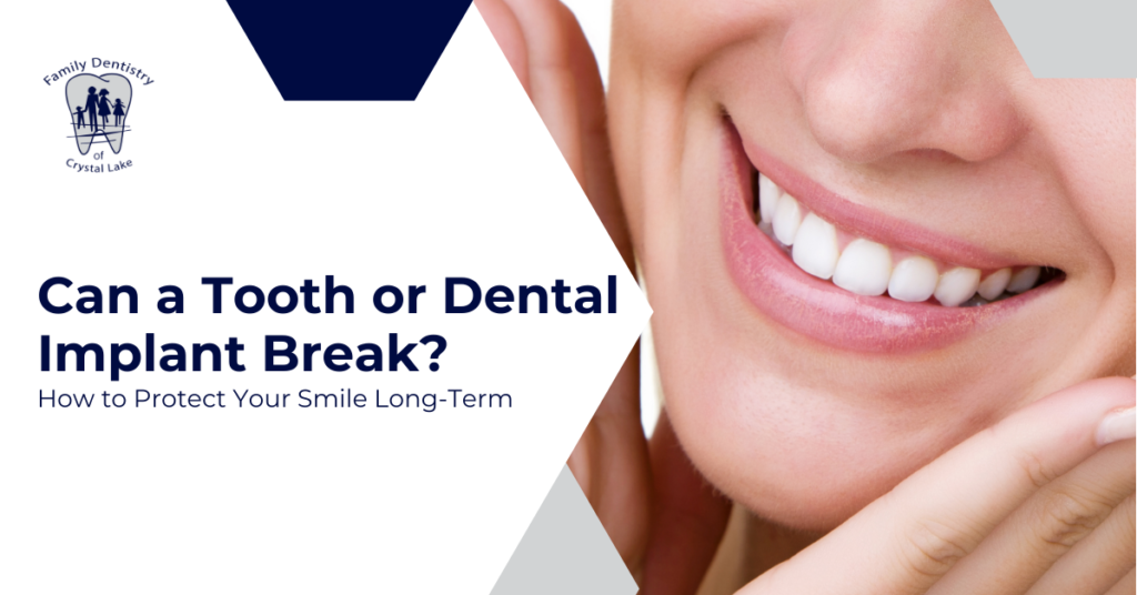 Can a Tooth or Dental Implant Break? How to Protect Your Smile Long-Term 5 Can a Tooth or Dental Implant Break? How to Protect Your Smile Long-Term | FDC Cover Can a Tooth or Dental Implant Break How to Protect Your Smile Long Term 1 | Family Dentistry of Crystal Lake