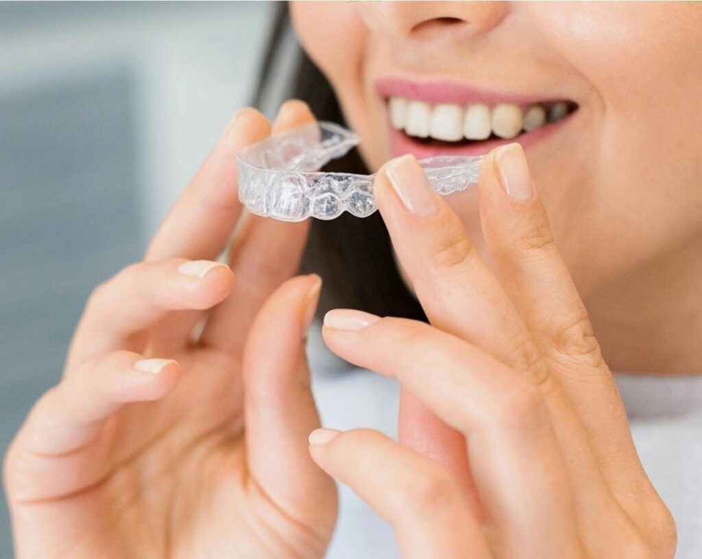 Traditional Braces & Retainers 14 Traditional Braces & Retainers
