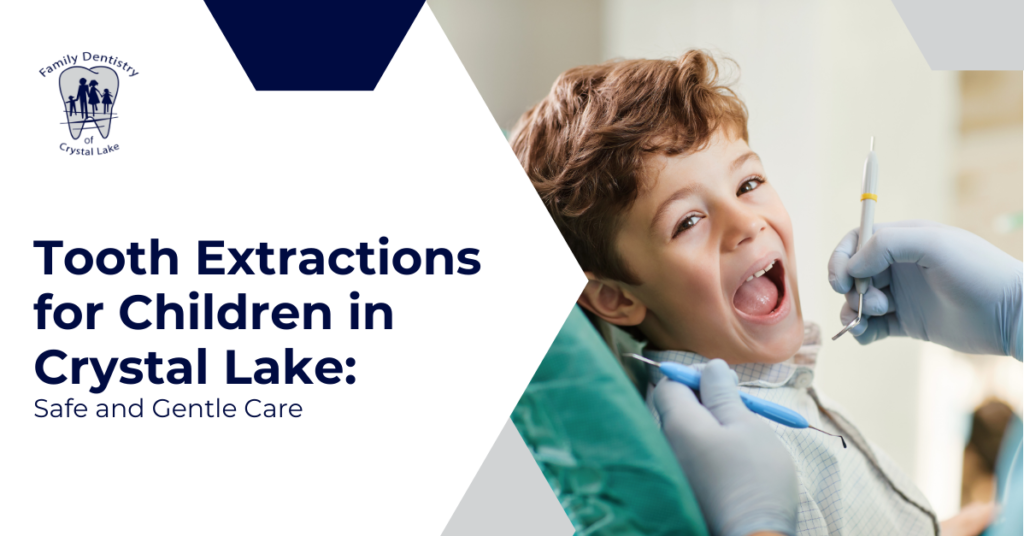 Tooth Extractions for Children in Crystal Lake: Safe and Gentle Care