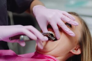 Tooth Extractions for Children in Crystal Lake: Safe and Gentle Care 1 When Are Tooth Extractions Needed for Children?