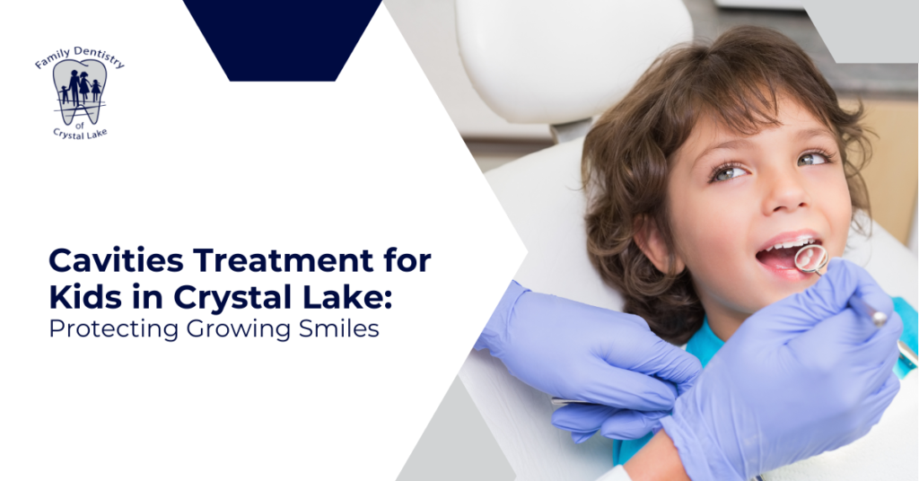 Cavities Treatment for Kids in Crystal Lake: Protecting Growing Smiles 25 Cavities Treatment for Kids in Crystal Lake: Protecting Growing Smiles