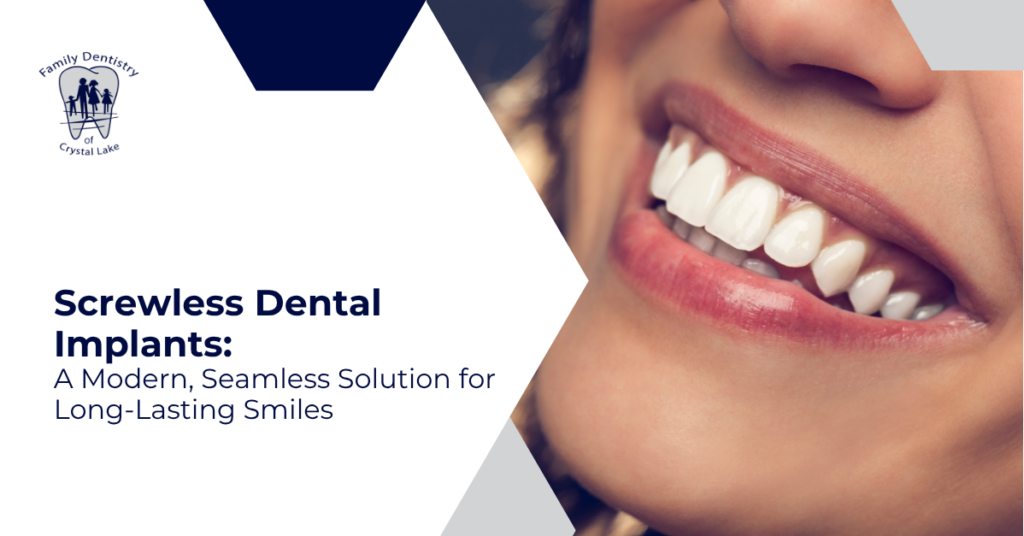 Screwless Dental Implants: A Modern, Seamless Solution for Long-Lasting Smiles 7 Screwless Dental Implants: A Modern, Seamless Solution for Long-Lasting Smiles