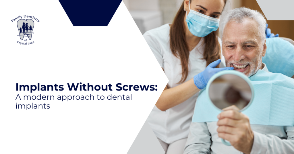 Implants Without Screws: A Modern Approach to Dental Implants