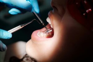 Best Dentist for Toddlers in Crystal Lake: What Parents Should Look For 2 What to Expect at Your Toddler’s First Visit