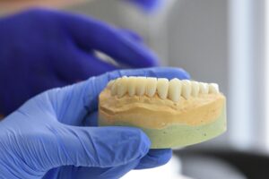 Screwless Dental Implants: A Modern, Seamless Solution for Long-Lasting Smiles 1 What Makes Screwless Dental Implants Different?