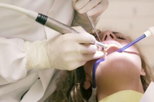 What Is the 50-40-30 Rule in Dentistry? 1 Filling vs Crown: What’s the Difference?