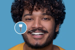 Single Tooth Implant Cost Without Insurance 1 What Is a Single Tooth Dental Implant?