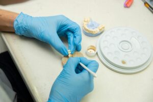 How Long Does It Take for Dental Implants to Heal? A Realistic Recovery Timeline 2 Bone Quality and Overall Health