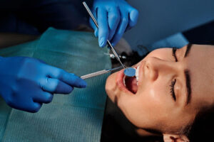 How Long After a Dental Cleaning Can I Eat? 2 Patient receiving a professional dental cleaning during a routine preventive dental exam in Crystal Lake.