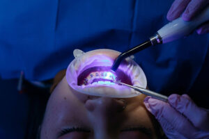 Teen Orthodontic Readiness: When Should Your Teenager Get Braces? 2 Teen patient undergoing an orthodontic evaluation with braces during a dental appointment
