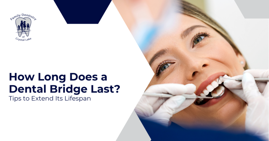 How Long Does a Dental Bridge Last? Tips to Extend Its Lifespan