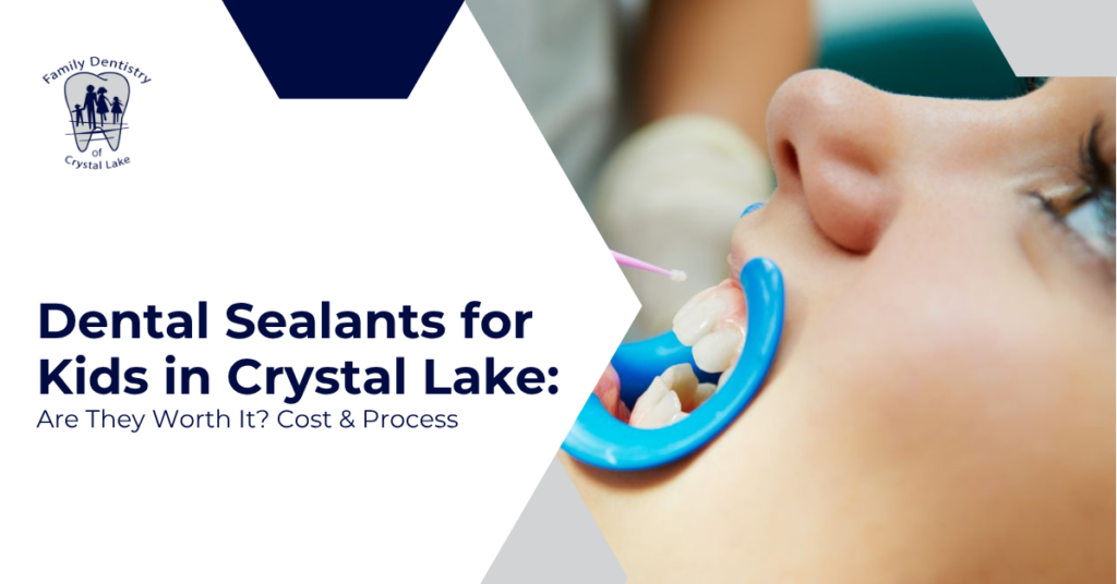 Dental Sealants for Kids in Crystal Lake: Are They Worth It? Cost & Process
