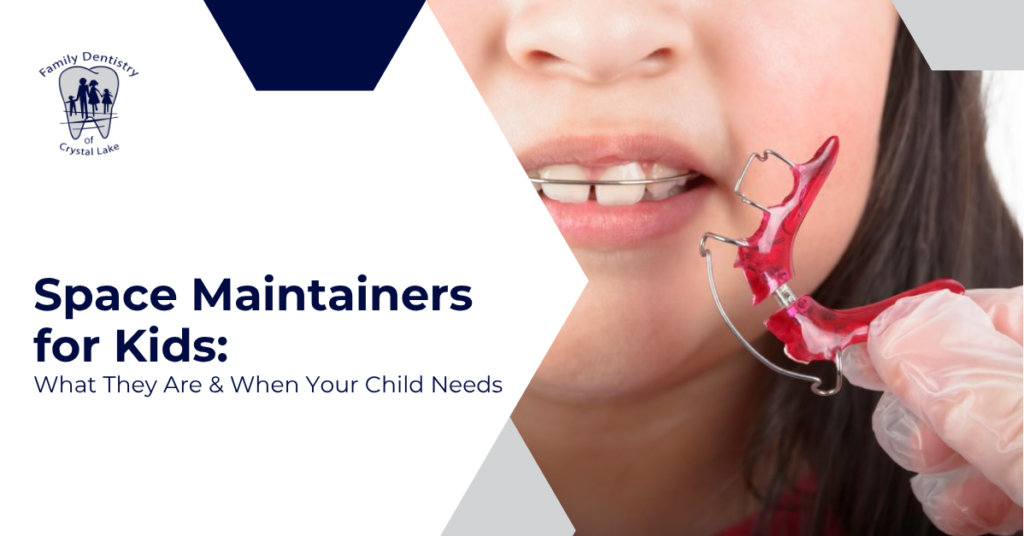 Space Maintainers for Kids: What They Are & When Your Child Needs One