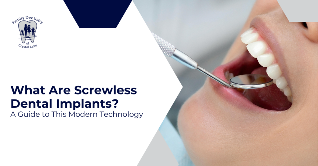 What Are Screwless Dental Implants? A Guide to This Modern Technology
