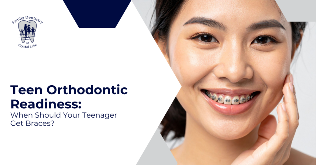 Teen Orthodontic Readiness: When Should Your Teenager Get Braces?