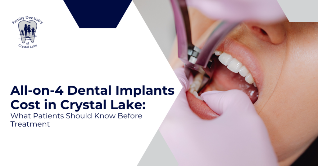 All-on-4 Dental Implants Cost in Crystal Lake: What Patients Should Know Before Treatment