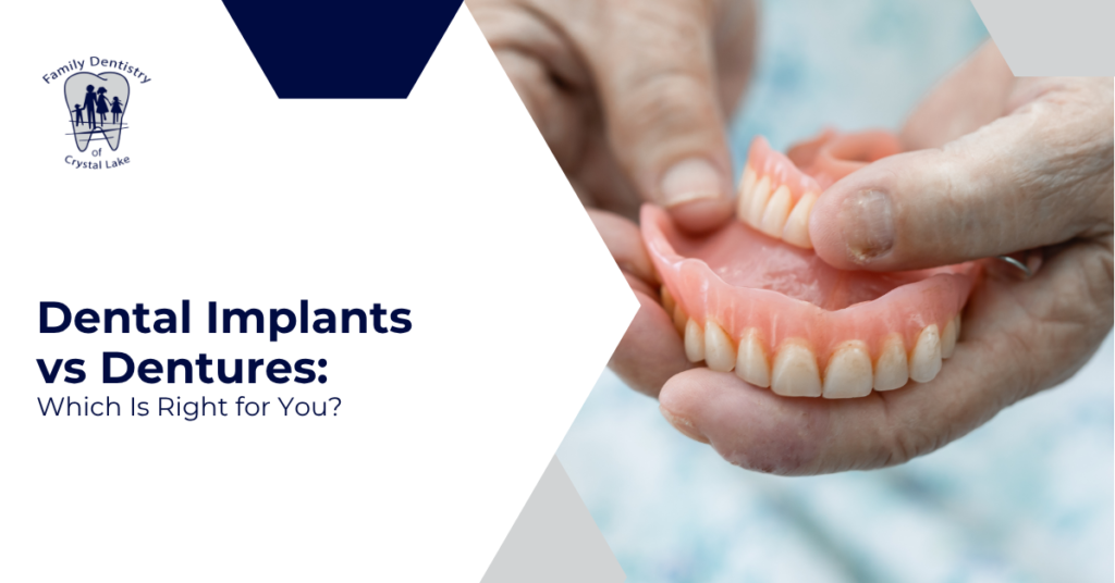 Dental Implants vs Dentures: Which Is Right for You?