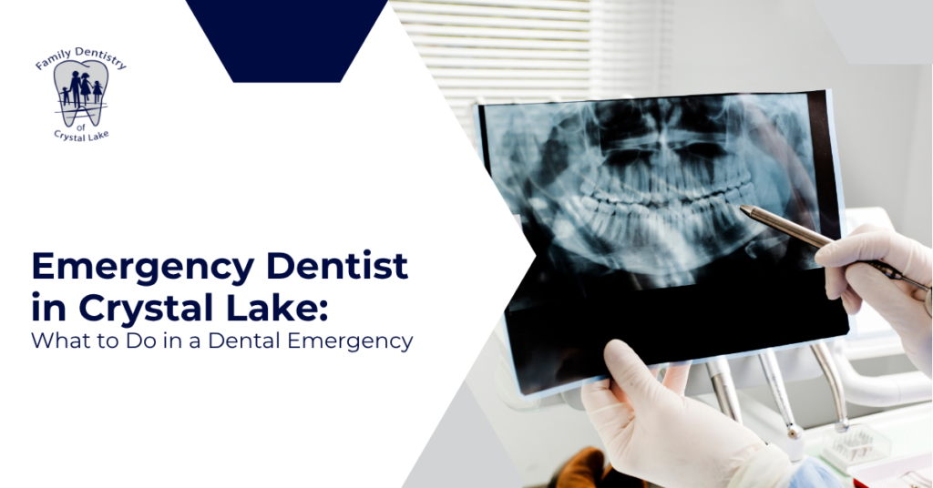 Emergency Dentist in Crystal Lake: What to Do in a Dental Emergency