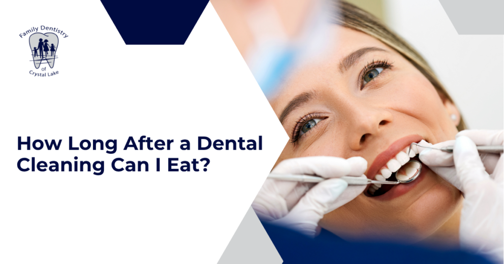 How Long After a Dental Cleaning Can I Eat? 27 How Long After a Dental Cleaning Can I Eat?