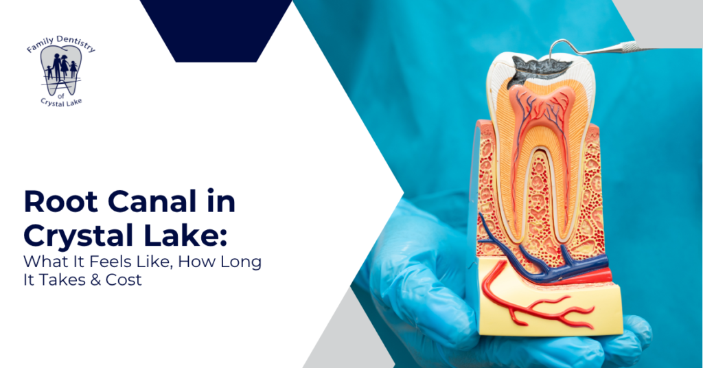 Root Canal in Crystal Lake: What It Feels Like, How Long It Takes & Cost