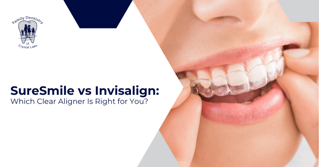 SureSmile vs Invisalign: Which Clear Aligner Is Right for You?
