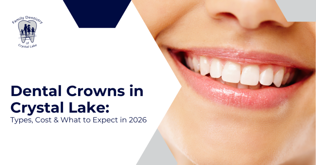 Dental Crowns in Crystal Lake: Types, Cost & What to Expect in 2026