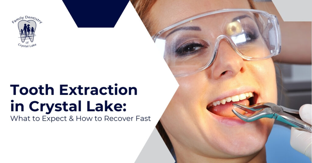 Tooth Extraction in Crystal Lake