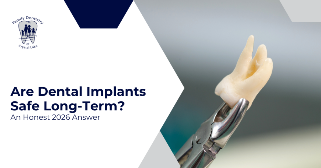 Are Dental Implants Safe Long-Term? An Honest 2026 Answer
