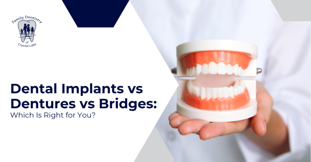 Dental Implants vs Dentures vs Bridges: Which Is Right for You?