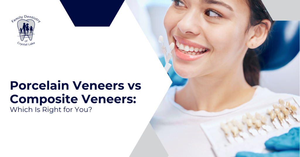 Porcelain Veneers vs Composite Veneers: Which Is Right for You?