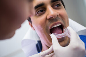 SureSmile vs Invisalign: Which Clear Aligner Is Right for You? 2 Dentist fitting a clear orthodontic aligner for a male patient during treatment.