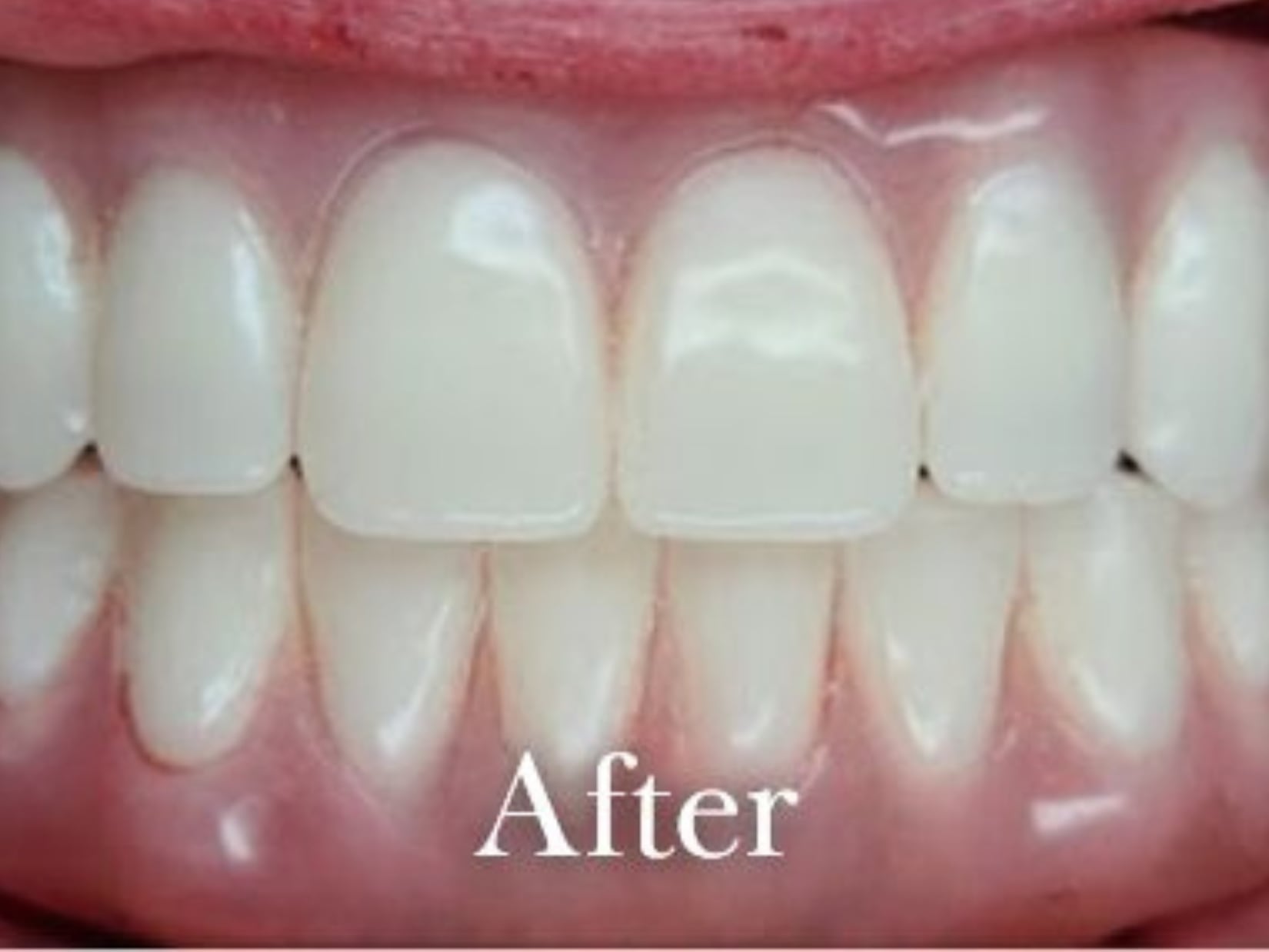 Dr. Adrian Rayyan 5 After All-on-X treatment