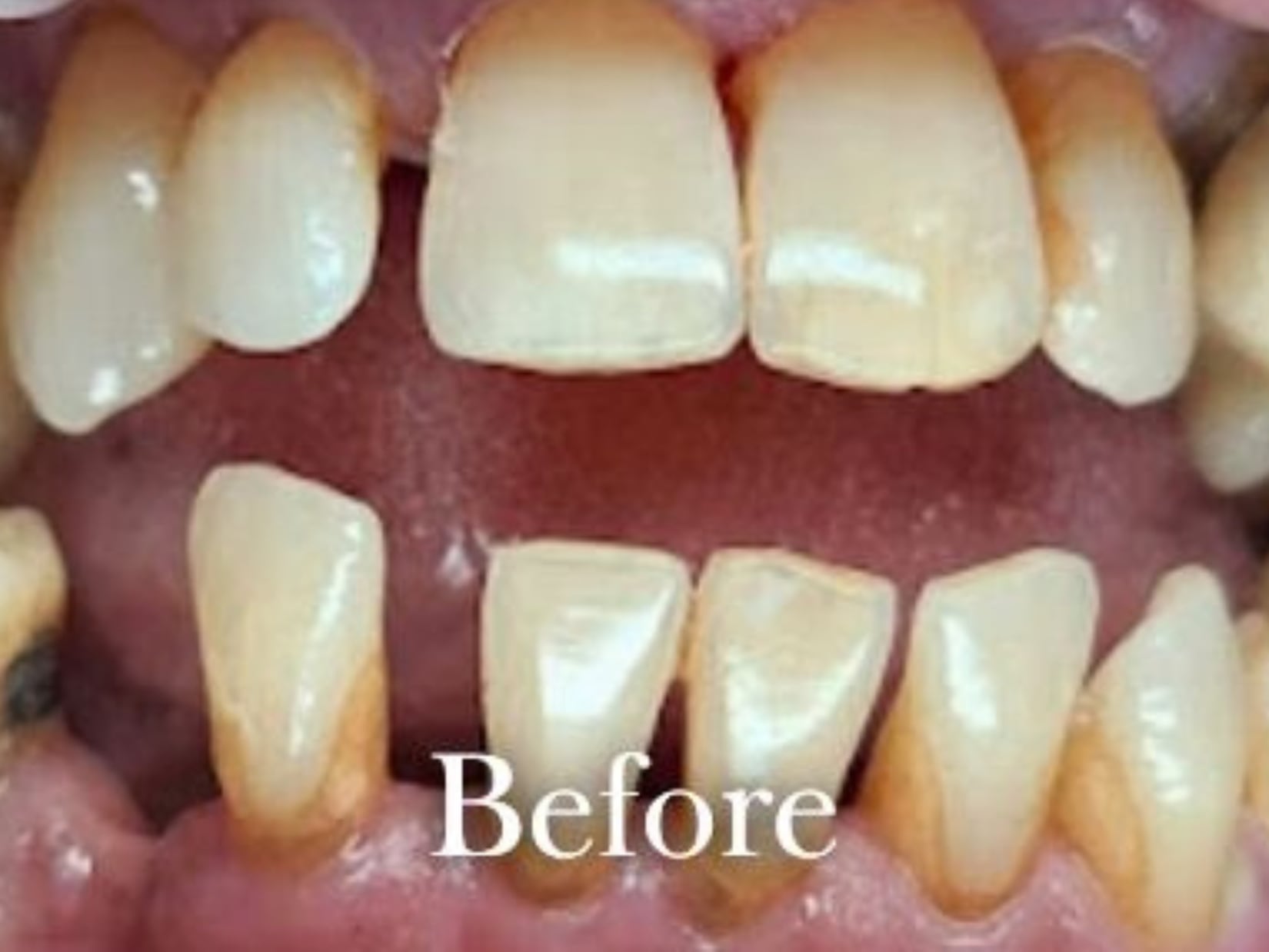 Dr. Adrian Rayyan 4 Before treatment
