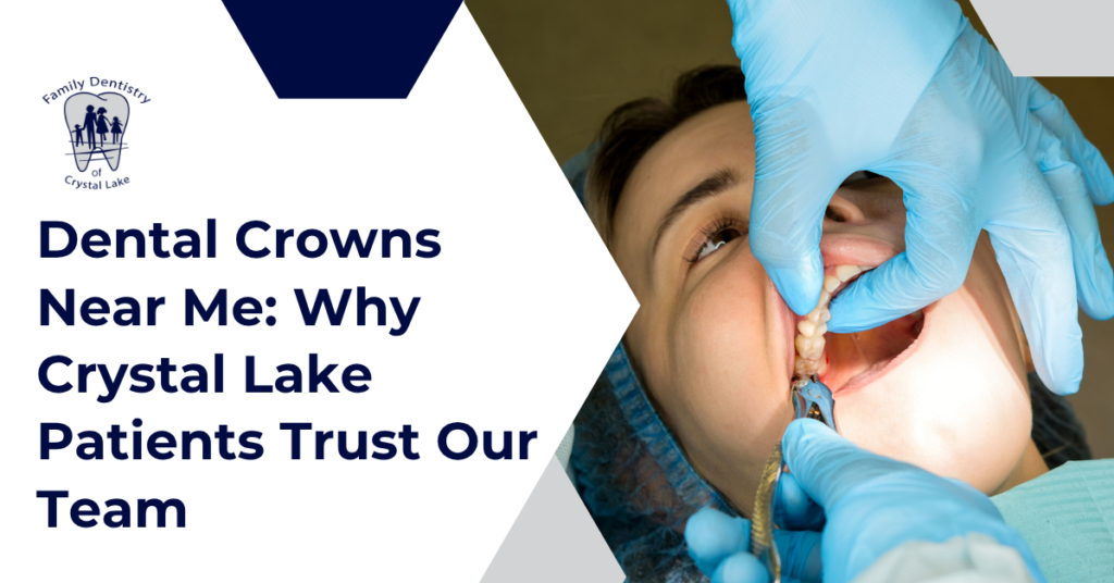 Dental Crowns Near Me: Why Crystal Lake Patients Trust Our Team