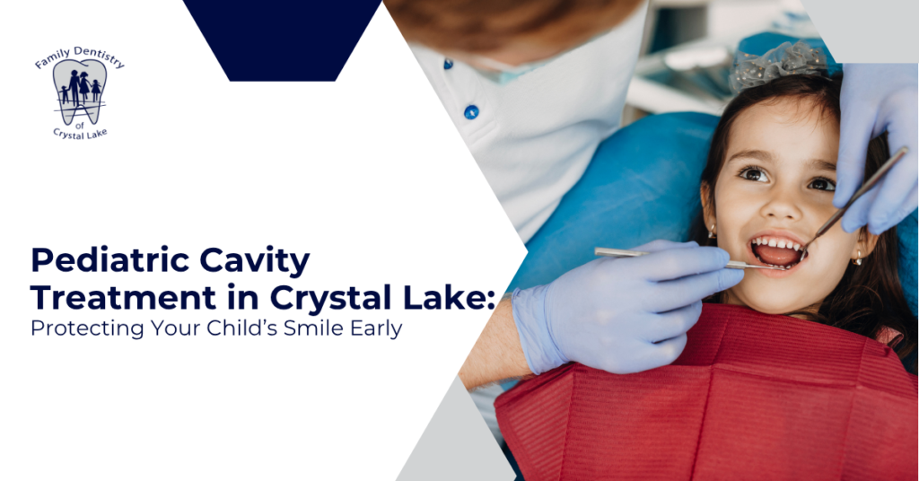 Pediatric Cavity Treatment in Crystal Lake: Protecting Your Child's Smile Early