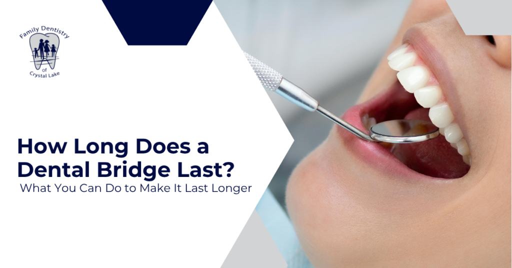 How Long Does a Dental Bridge Last? What You Can Do to Make It Last Longer 7 How Long Does a Dental Bridge Last? What You Can Do to Make It Last Longer